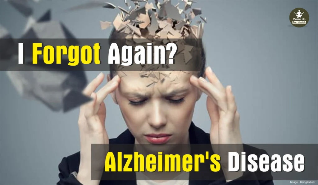 Understanding Alzheimer Disease 1 Alzheimer's Disease : Causes, Symptoms and Treatment. Why Alzheimer's Attacks?