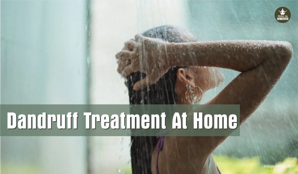 DANDRUFF TREATMENT AT HOME