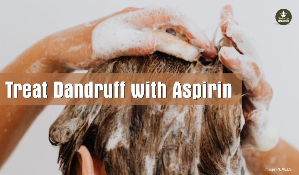 Treat Dandruff with Aspirin