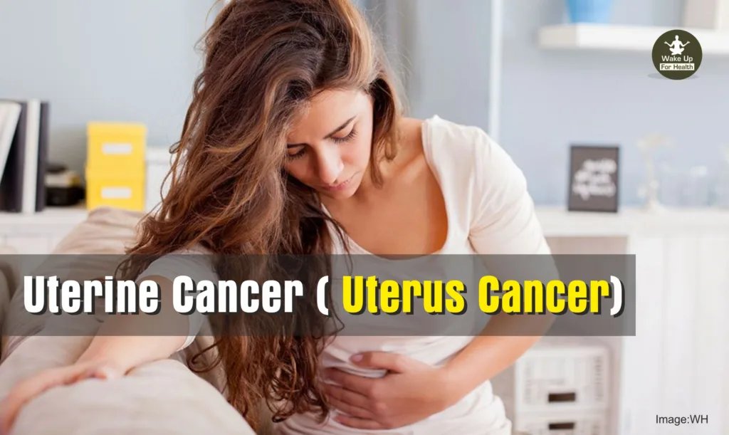 Uterine Cancer (Endometrial Cancer) Symptoms, Causes, Diagnosis & Treatment
thickened endometrium,endometrial cancer,endometrium,endometrial hyperplasia,uterus cancer,uterine,uterine polyps,endometrial,uterine adenomyosis,endometrial cancer staging,endometrioid adenocarcinoma,endometrial polyps,disordered proliferative endometrium,uterine sarcoma,uterine lining,womb cancer,proliferative endometrium,endometrial hyperplasia ultrasound,uterine polyps treatment,uterine hyperplasia,