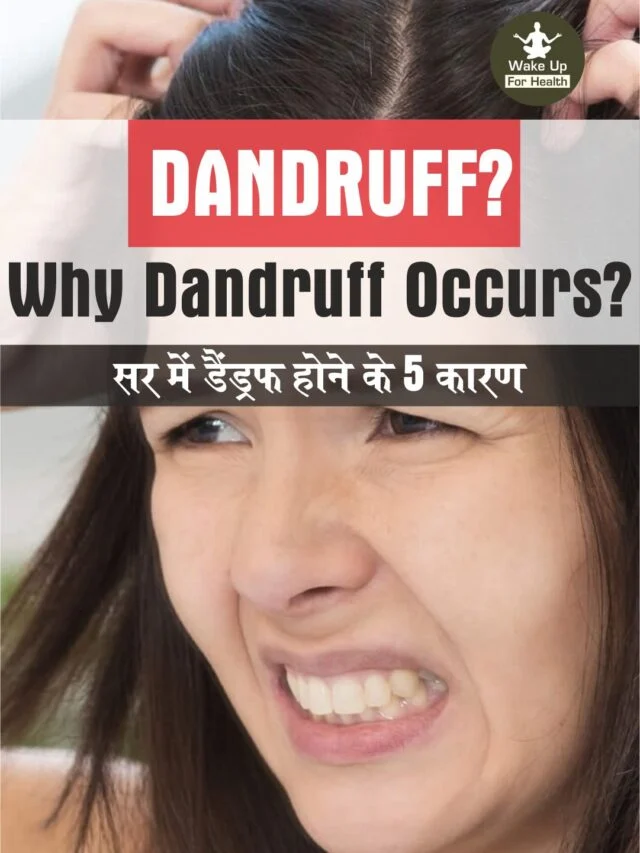 Dandruff Symptoms Causes And Treatment Wfh