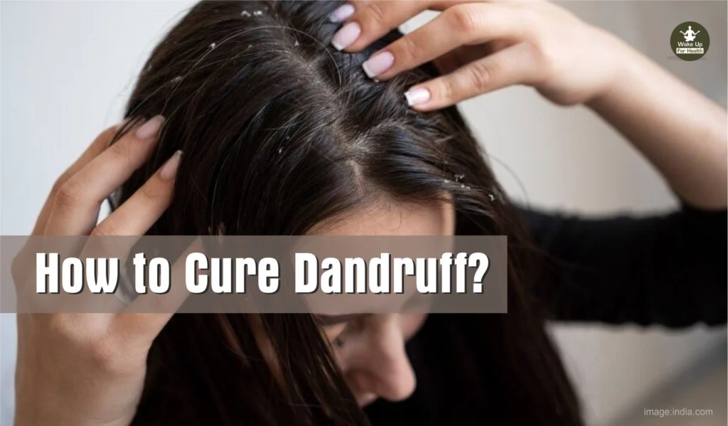 Why Dandruff Occurs? Dandruff : Symptoms, Causes and Treatment