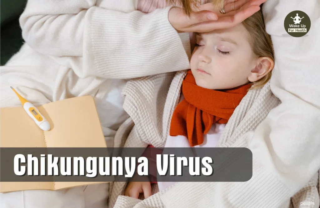 Chikungunya is a disease spread by mosquitoes. This disease is very common in the countries of Africa and Asia. However, some cases of this mosquito-borne disease have also been found in parts of Europe and America.