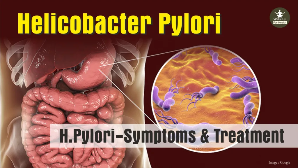 H.Pylori-Symptoms & Treatment