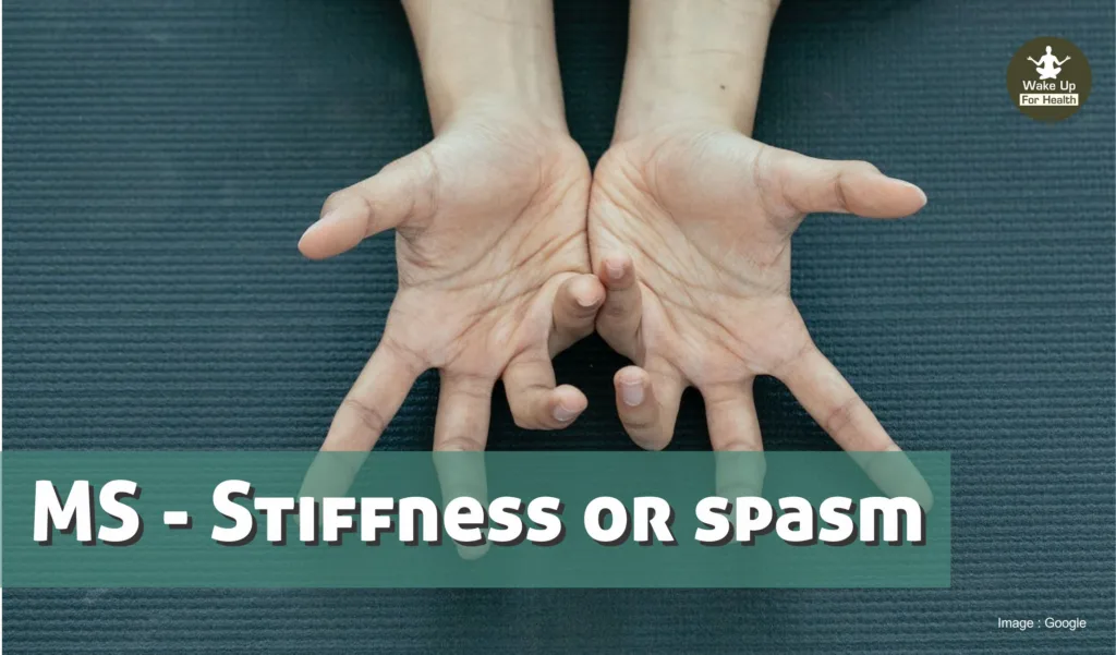 Multiple Sclerosis: Understanding Symptoms and Treatment 3 Multiple Sclerosis - MS Symptoms, Types, Diagnose, Treatment & Diet