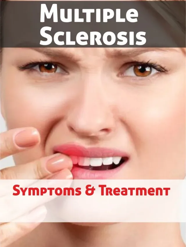 Multiple Sclerosis – MS Symptoms, Treatment & Diet