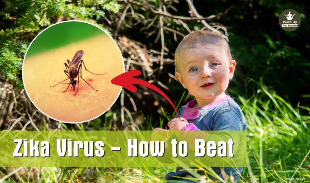 Zika Virus - How to Beat | Know Causes, Symptoms, Prevention and Treatment