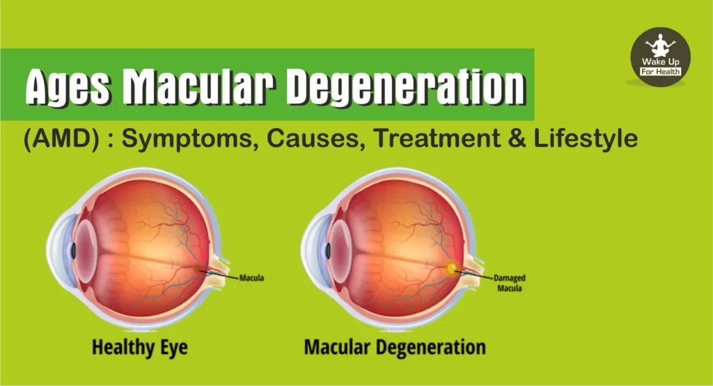 Ages Macular Degeneration (AMD) : Symptoms, Causes, Treatment & Lifestyle