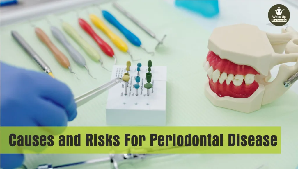 gum disease,periodontal disease,periodontitis,periodontal,gum disease treatment,scaling teeth,periodontitis treatment,periodontal disease treatment,periodontal pocket,periodontal surgery,chronic periodontitis,gum treatment,periodontal cleaning,advanced periodontal disease,periodontal scaling,gum decay,periodontal gum disease,chronic gingivitis,periodontitis gums,severe gum disease,deep gum cleaning,periodontal therapy,advanced periodontitis,periodontal infection,reverse gum disease,advanced gum disease,severe periodontal disease, teeth disease,tooth decay,gum disease symptoms,tooth decay treatment,gum infection symptoms,bleeding gums causes,tooth decay symptoms,periodontitis symptoms,dental problems,bleeding gums cancer,dental sinus infection symptoms,dental diseases,dental caries treatment,gum disease causes,teeth cancer symptoms,early stage wisdom tooth infection,ayurvedic treatment for teeth cavities,yellow teeth disease,oral and dental problems,severe periodontal disease,tooth decay treatment cost,dental plaque symptoms,

