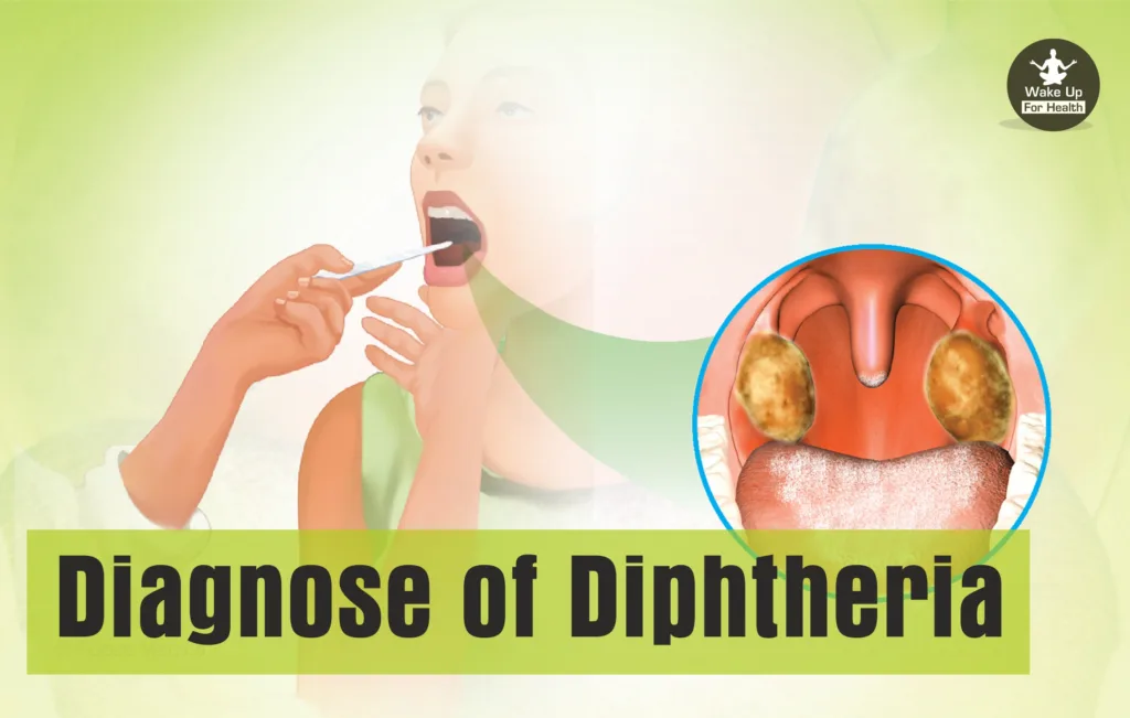 Diphtheria Toxin: Causes, Symptoms, Types and Treatment 3 Diphtheria,diphtheria vaccine,diphtheria symptoms,diphtheria is caused by,diphtheria tetanus pertussis,diphtheria definition,diphtheria disease,diphtheria treatment,diphtheria toxin,tetanus diphtheria,diphtheria antitoxin,diphtheria toxoid,diphtheria prevention,diphtheria vaccine name,types of diphtheria,tetanus and diphtheria,diphtheria complications,diphtheria diagnosis,diphtheria epidemic,diphtheria signs and symptoms,diphtheria and tetanus vaccine,diphtheria tetanus vaccine,diphtheria antibiotics,diphtheria test,diphtheria meaning in hindi,cutaneous diphtheria,diphtheria causes,diphtheria bacteria,faucial diphtheria,diphtheria transmission,pharyngeal diphtheria,diphtheria is caused by which bacteria,diphtheria vaccine history,
