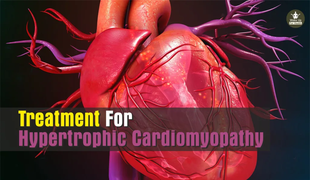 Exploring Hypertrophic Cardiomyopathy: Symptoms And Treatments