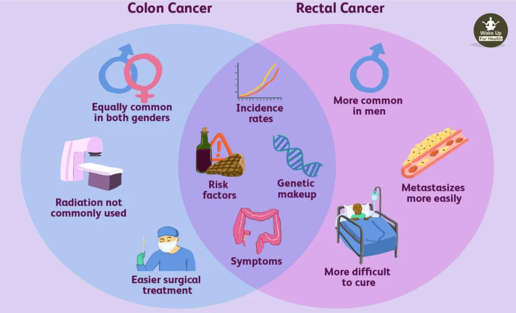 Colorectal Cancer - Why Colon Cancer Occurs, Symptoms, Types and Treatment, Medication 2 rectal cancer,colorectal cancer,colon cancer,colorectal,stage 4 colon cancer,colon cancer treatment,colon cancer screening,colorectal cancer screening,stage 3 colon cancer,adenocarcinoma colon,bowel cancer screening,uspstf colon cancer screening,malignant neoplasm of colon,colon cancer surgery,metastatic colon cancer,colorectal cancer treatment,colonoscopy screening,colorectal carcinoma,rectal cancer treatment,colorectal screening,rectal adenocarcinoma,sigmoid cancer,colon cancer in women,large intestine cancer,types of colon cancer,colon cancer prevention,colonoscopy recommendations,rectal carcinoma,rectal surgery,hereditary nonpolyposis colorectal cancer,stage 3 rectal cancer,colon rectal surgeons,colorectal adenocarcinoma,colon cancer,colorectal cancer,colorectal,colon polyps,stage 4 colon cancer,colonoscopy age,colon cancer treatment,colon pain,colon cancer screening,colorectal cancer screening,adenocarcinoma colon,colon problems,colon surgery,colon spasms,colon pain left side,colon inflammation,colon removal,colon cancer prognosis,sigmoid colon pain,colon health,colon pain right side,colon cancer surgery,colorectal cancer treatment,types of colon polyps,colonoscopy screening,ascending colon pain,
