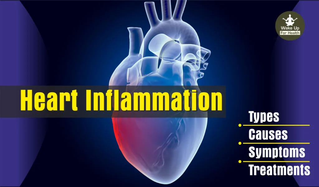 Heart Inflammation: Types, Causes, Symptoms and Treatments