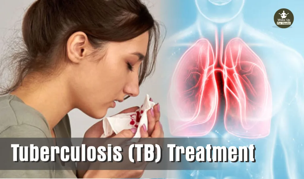 Tuberculosis (TB) Symptoms, Cause, Treatment, Diet and Home Remedies