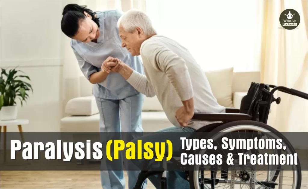 Paralysis,bell's palsy,erbs palsy,facial palsy,bell's palsy treatment,facial paralysis,bulbar palsy,facial nerve palsy,radial nerve palsy,spastic paralysis,hypokalemic periodic paralysis,vocal cord paralysis,ulnar nerve palsy,paralysis treatment,types of paralysis,erb duchenne palsy,cranial nerve palsy,periodic paralysis,erbs paralysis,hyperkalemic periodic paralysis,nerve palsy,facial nerve paralysis,infantile paralysis,facial palsy treatment,ascending paralysis,vocal cord palsy,peroneal nerve palsy,progressive bulbar palsy,temporary paralysis,partial paralysis,palsy types,phrenic nerve palsy,thyrotoxic periodic paralysis,bell's palsy physical therapy,sudden leg paralysis in adults,paralyzed diaphragm,facial paralysis treatment,sudden temporary paralysis,bell's palsy cranial nerve,brachial palsy,central facial palsy,bell's palsy nerve,anxiety paralysis,brain paralysis,cerebral paralysis,right sided hemiplegia,facial nerve damage,paralysis disease,leg paralysis,facial nerve palsy treatment,vocal cord paralysis treatment,paralyzed from the waist down,femoral nerve palsy,hypokalemic paralysis,bilateral vocal cord paralysis,bell's paralysis,erb's palsy treatment,phrenic nerve paralysis,paralysis treatment at home,