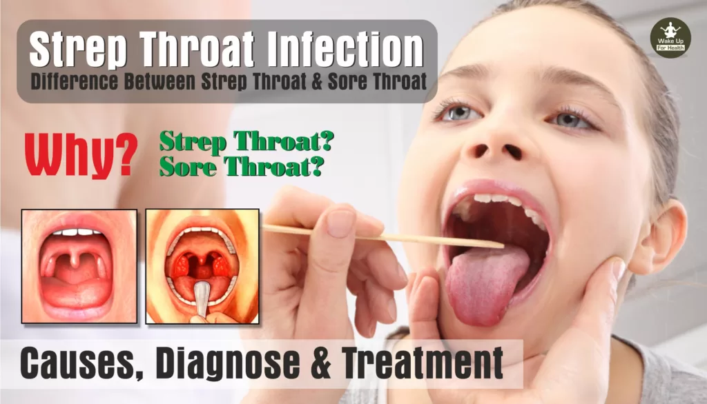 strep throat, sore throat, strep throat treatment, sore throat treatment,