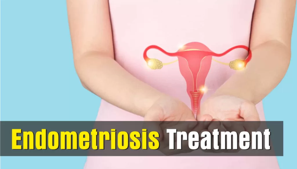 Endometriosis Treatment LATEST