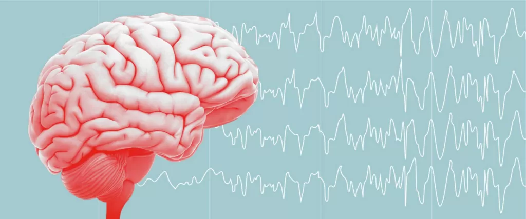 What is Epilepsy : Symptoms, Causes, Treatment 2 epilepsy treatment