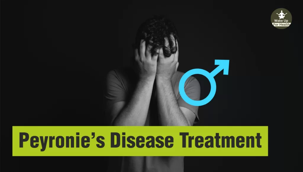 Peyronie's Disease Treatment | Penile Curvature Symptoms, Treatment, Home Remedies, Diet - wakeupforhealth.com