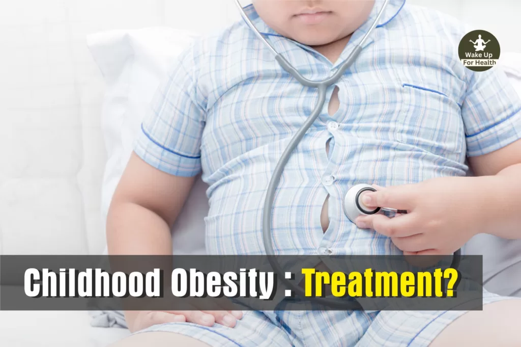 Childhood Obesity | Symptoms, Causes, Prevention and Treatment 2 childhood obesity treatment