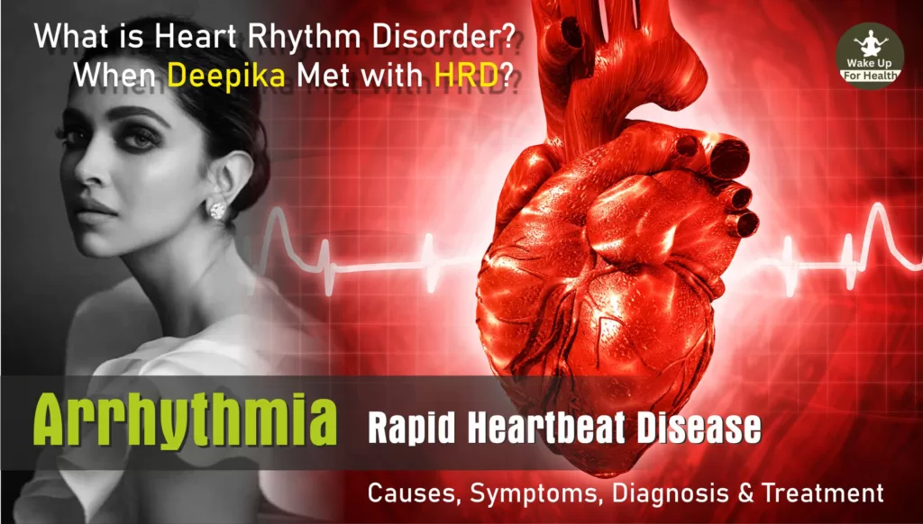 Heart Rhythm Disorder