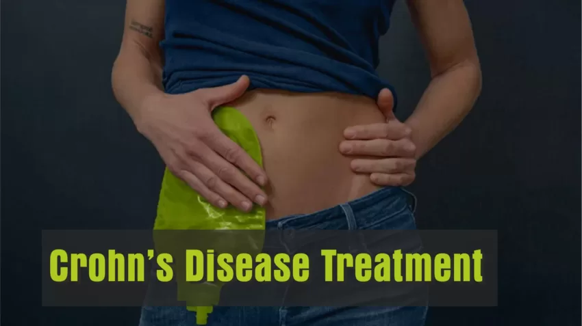 crohn-s-disease-explained-symptoms-diagnosis-and-treatment